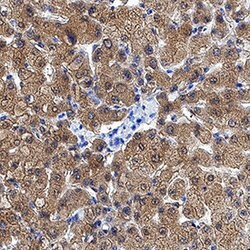 Human Ketohexokinase Antibody, R D Systems 100 &mu;g; Unconjugated:Antibodies,