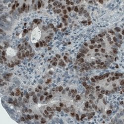 Ki67/MKI67 Antibody (CL1234), Novus Biologicals 25 &mu;L; Unconjugated:Antibodies,