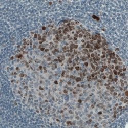 Ki67/MKI67 Antibody (CL1234), Novus Biologicals 25 &mu;L; Unconjugated:Antibodies,