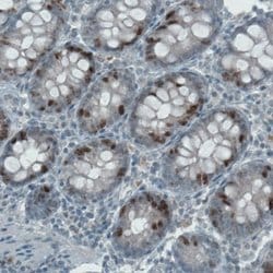 Ki67/MKI67 Antibody (CL1234), Novus Biologicals 25 &mu;L; Unconjugated:Antibodies,