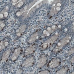 Ki67/MKI67 Antibody (CL1234), Novus Biologicals 25 &mu;L; Unconjugated:Antibodies,