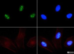 Ki67/MKI67 Antibody, DyLight 594, Novus Biologicals 0.1mL:Antibodies, Polyclonal