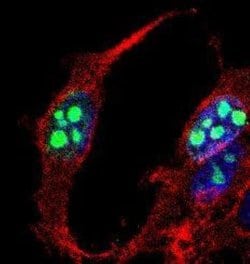 Ki67/MKI67 Antibody, DyLight 594, Novus Biologicals 0.1mL:Antibodies, Polyclonal