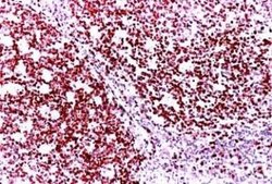 Ki67/MKI67 Antibody, DyLight 594, Novus Biologicals 0.1mL:Antibodies, Polyclonal
