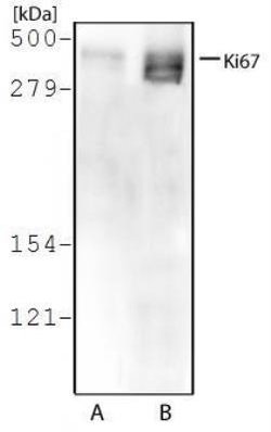 Ki67/MKI67 Antibody, DyLight 594, Novus Biologicals 0.1mL:Antibodies, Polyclonal