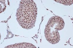 Kif4A Rabbit anti-Human, Mouse, Rat, Clone: 4A9P2, Novus Biologicals 100