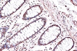 Kif4A Rabbit anti-Human, Mouse, Rat, Clone: 4A9P2, Novus Biologicals 100