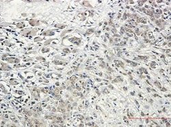 Kinesin 5B Rabbit anti-Human, Mouse, Rat, Clone: S04-6G8, Novus Biologicals