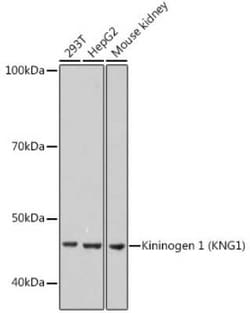 Kininogen 1 Rabbit anti-Human, Mouse, Rat, Clone: 8O3B3, Novus Biologicals 100 &mu;g | Buy Online | Novus Biologicals | Fisher Scientific