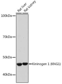 Kininogen 1 Rabbit anti-Human, Mouse, Rat, Clone: 8O3B3, Novus Biologicals 100 &mu;g | Buy Online | Novus Biologicals | Fisher Scientific