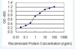 Kir3.4 Antibody (8D2), Novus Biologicals 100 &mu;g | Buy Online | Novus Biologicals | Fisher Scientific