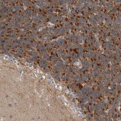 Kir3.1 Antibody, Novus Biologicals 0.1 mL | Buy Online | Novus Biologicals | Fisher Scientific