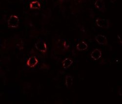 Kirrel3/NEPH2 Antibody - BSA Free, Novus Biologicals 0.1 mg | Buy Online | Novus Biologicals | Fisher Scientific