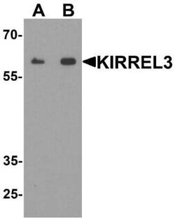 Kirrel3/NEPH2 Antibody - BSA Free, Novus Biologicals 0.1 mg | Buy Online | Novus Biologicals | Fisher Scientific