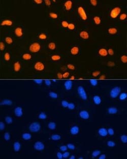 Ku80/XRCC5 Rabbit anti-Human, Clone: 7N7G3, Novus Biologicals 20 &mu;g;