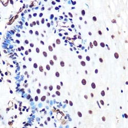 Ku80/XRCC5 Rabbit anti-Human, Clone: 7N7G3, Novus Biologicals 20 &mu;g;