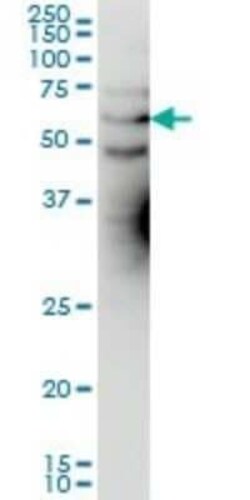 Kv1.3 Antibody (1D8), Novus Biologicals 0.1 mg | Buy Online | Novus Biologicals | Fisher Scientific