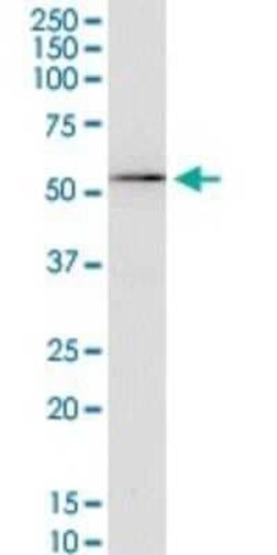 Kv1.3 Antibody (1D8), Novus Biologicals 0.1 mg | Buy Online | Novus Biologicals | Fisher Scientific