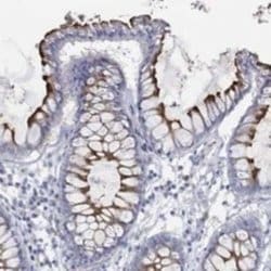 Kv1.1 Rabbit anti-Human, Polyclonal, Novus Biologicals 100 &mu;g; Unconjugated:Antibodies,
