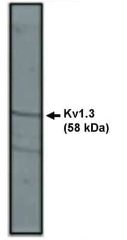 Kv1.3 Rabbit anti-Human, Mouse, Rat, Polyclonal, Novus Biologicals:Antibodies:Primary
