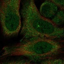 Kv10.2 Rabbit anti-Human, Polyclonal, Novus Biologicals 100 &mu;g; Unconjugated:Antibodies,