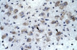 Kv10.2 Rabbit anti-Human, Polyclonal, Novus Biologicals 0.1ml; Unconjugated:Antibodies,