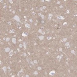 Kv11.2 Rabbit anti-Human, Polyclonal, Novus Biologicals 25 &mu;g; Unconjugated:Antibodies,