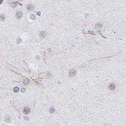 Kv12.1 Rabbit anti-Human, Polyclonal, Novus Biologicals 100 &mu;g; Unconjugated:Antibodies,