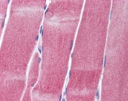 Kv3.4 Rabbit anti-Human, Polyclonal, Novus Biologicals 0.1ml; Unconjugated:Antibodies,