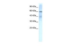 Kv4.3 Antibody, Novus Biologicals 100 &mu;L; Unconjugated:Anticuerpos