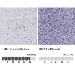 Kv5.1 Antibody, Novus Biologicals 100 &mu;g; Unconjugated:Antikörper