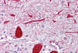 Kv7.2 Rabbit anti-Human, Mouse, Polyclonal, Novus Biologicals 0.1 mL | Buy Online | Novus Biologicals | Fisher Scientific