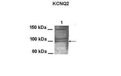 Kv7.2 Rabbit anti-Human, Mouse, Hamster, Polyclonal, Novus Biologicals 0.1 mL | Buy Online | Novus Biologicals | Fisher Scientific