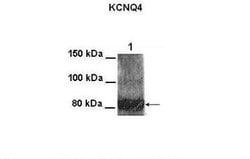 Kv7.4 Rabbit anti-Human, Hamster, Polyclonal, Novus Biologicals 0.1 mL | Buy Online | Novus Biologicals | Fisher Scientific