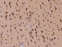 Kv7.5 Antibody, Novus Biologicals 50 &mu;g, Unconjugated:Antibodies, Polyclonal