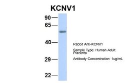 Kv8.1 Rabbit anti-Human, Polyclonal, Novus Biologicals 0.1 mL | Buy Online | Novus Biologicals | Fisher Scientific