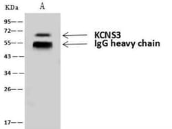 Kv9.3 Antibody, Novus Biologicals 50 &mu;g; Unconjugated:Anticorps, Polyclonal