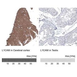 L1CAM Antibody (CL12988), Novus Biologicals 100 &mu;g; Unconjugated:Antibodies,