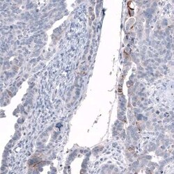 L1CAM Antibody (CL12988), Novus Biologicals 100 &mu;g; Unconjugated:Antibodies,