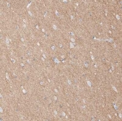 L1CAM Antibody, Novus Biologicals 0.1 mL; Unconjugated:Antikörper