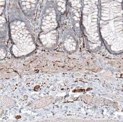 L1CAM Antibody, Novus Biologicals 0.1 mL; Unconjugated:Antikörper