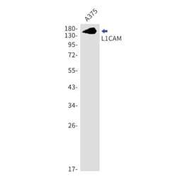 L1CAM Antibody (S04-8I3), Novus Biologicals 100 &mu;g; Unconjugated:Antibodies,