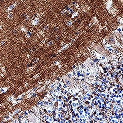 Human L1CAM Antibody, R D Systems 25 &mu;g | Buy Online | R&D Systems | Fisher Scientific