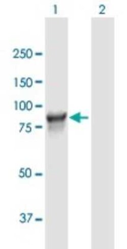L3MBTL3 Antibody, Novus Biologicals 0.05 mg; Unconjugated:Antibodies, Polyclonal