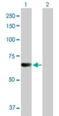 L3MBTL4 Antibody, Novus Biologicals 0.1 mg; Unconjugated:Antibodies, Polyclonal