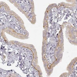 LAMC2 Antibody (CL2980), Novus Biologicals:Antibodies:Primary Antibodies