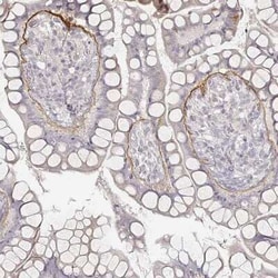 LAMC2 Antibody (CL2980), Novus Biologicals:Antibodies:Primary Antibodies