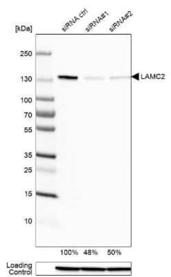 LAMC2 Antibody (CL2980), Novus Biologicals:Antibodies:Primary Antibodies