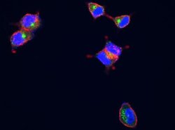 LAMP-1/CD107a Rabbit anti-Human, Clone: 107, Novus Biologicals:Antibodies:Primary