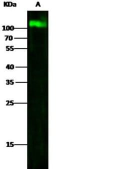 LAMP-1/CD107a Rabbit anti-Human, Clone: 107, Novus Biologicals:Antibodies:Primary